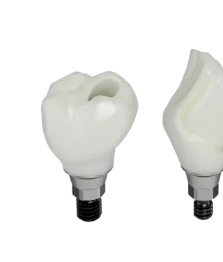 Procera™ solutions for labs